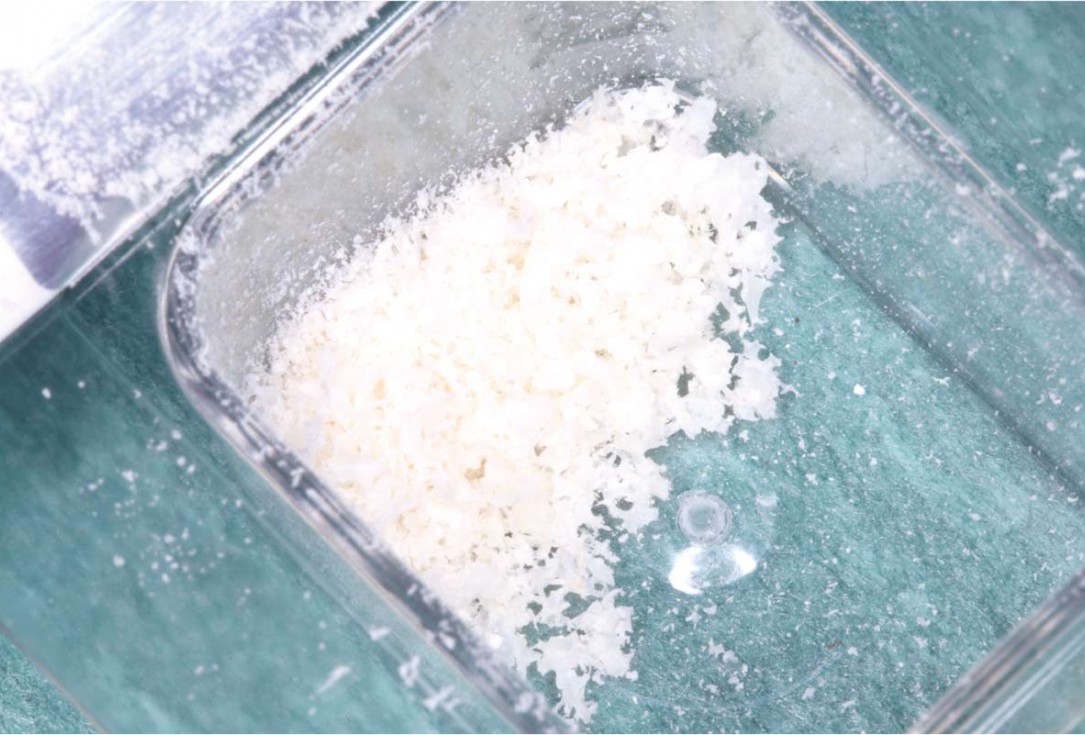 GBR using layering technique in aesthetic zone with maxgraft® and cerabone® -Dr. H. Maghaireh and Dr. V. Ivancheva