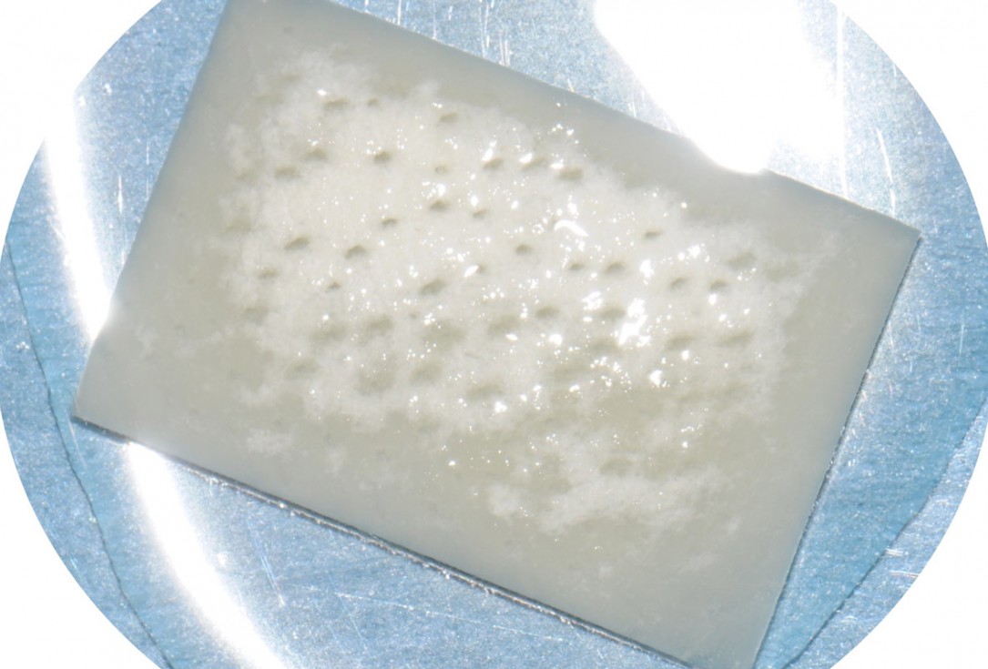 7/18 Tooth extraction and socket sealing with mucoderm® - Dr. A. Rossi