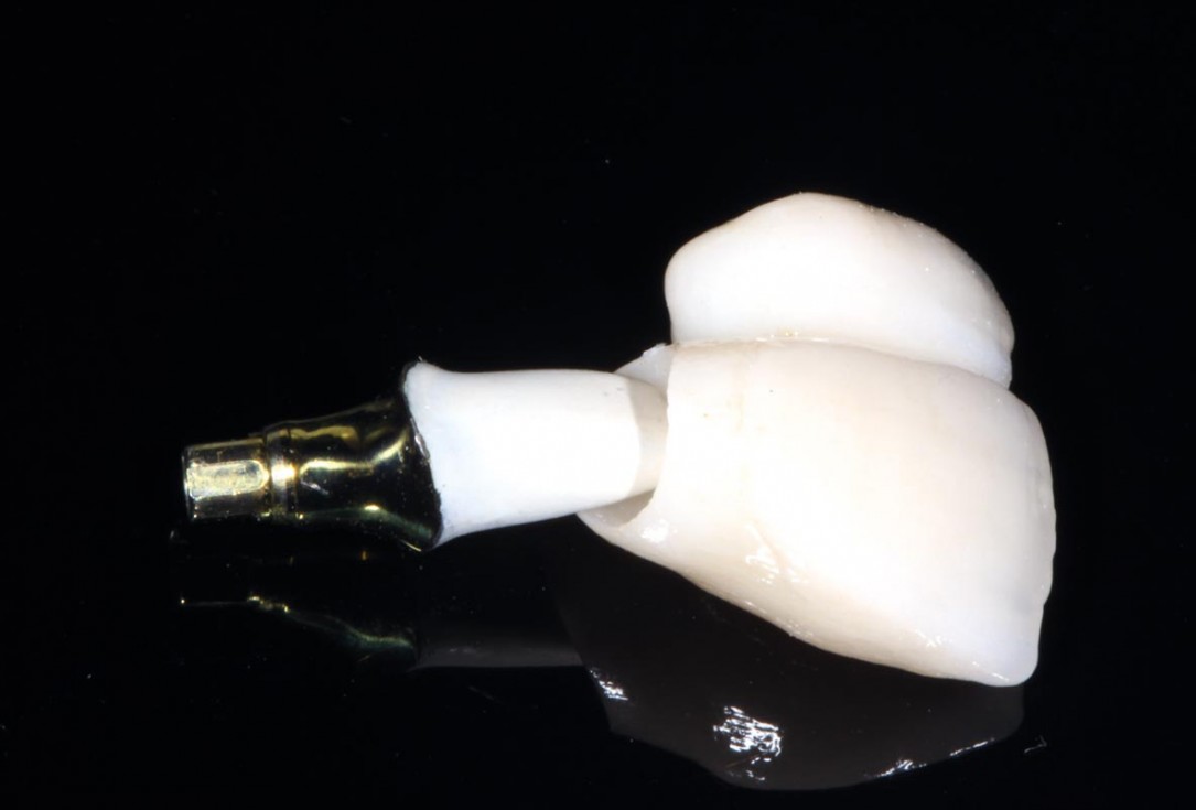 botiss-cerabone-permamem-maxgraft-mucoderm-horizontal-gbr-maghaireh