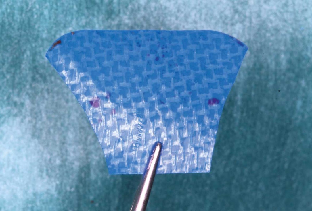 botiss-cerabone-permamem-maxgraft-mucoderm-horizontal-gbr-maghaireh