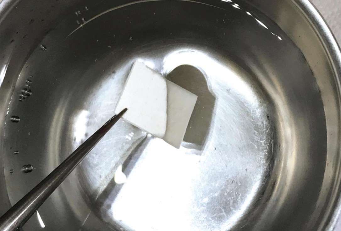 4/9 Soft tissue thickening with mucoderm® - Dr. G. de Deus